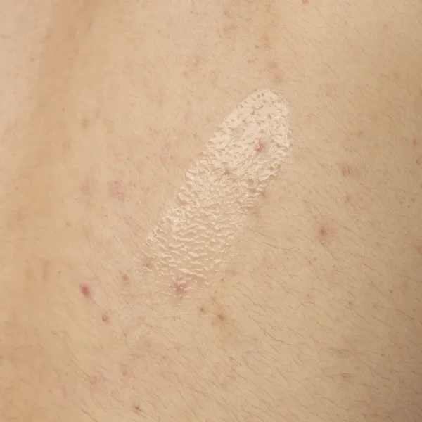 Salicylic Acid 0.5% Body Serum - Image 3