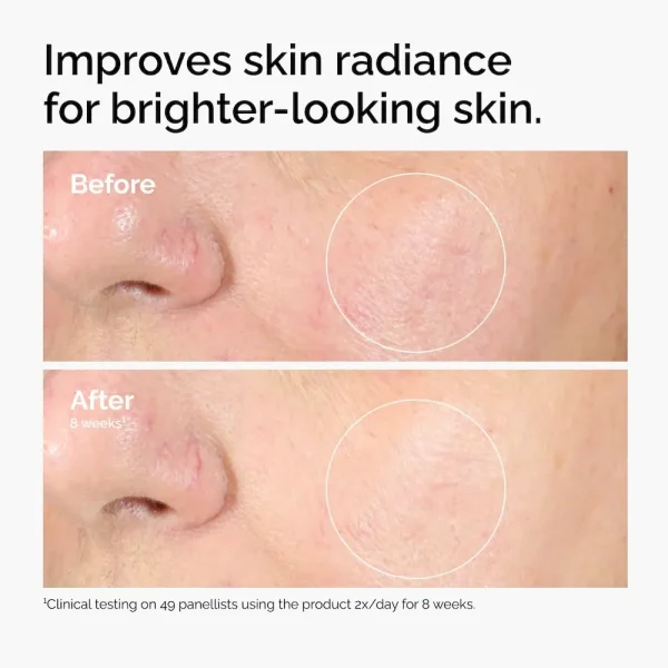 Alpha Arbutin 2% + HA - Image 5