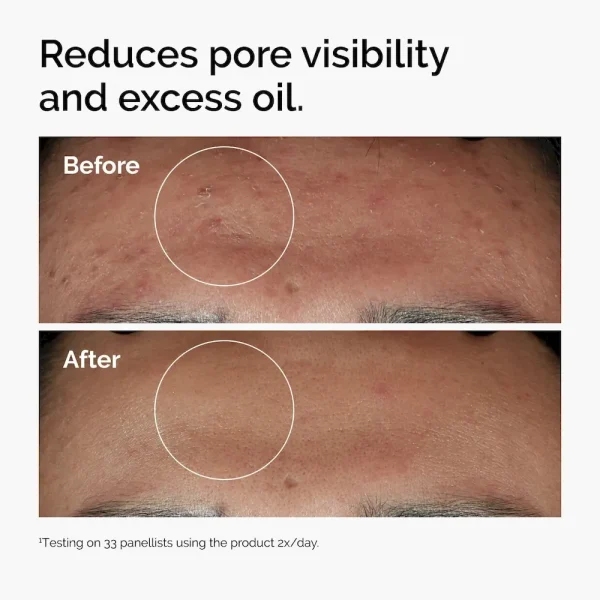 Niacinamide 10% + Zinc 1% - Image 3